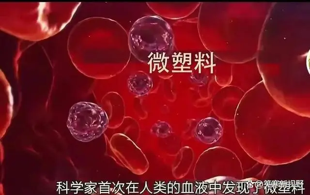 人类血栓中首次发现微塑料   隐形杀手出现了！